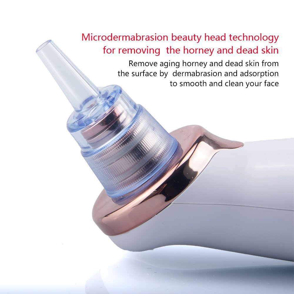 Blackhead Remover Pro – Устройство за вакуумно отстраняване на пори и почистване на лице