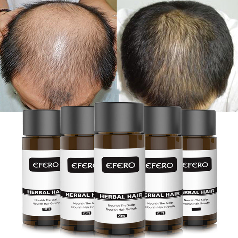 Efero Hair Growth Essence – Укрепващ и регенериращ серум 