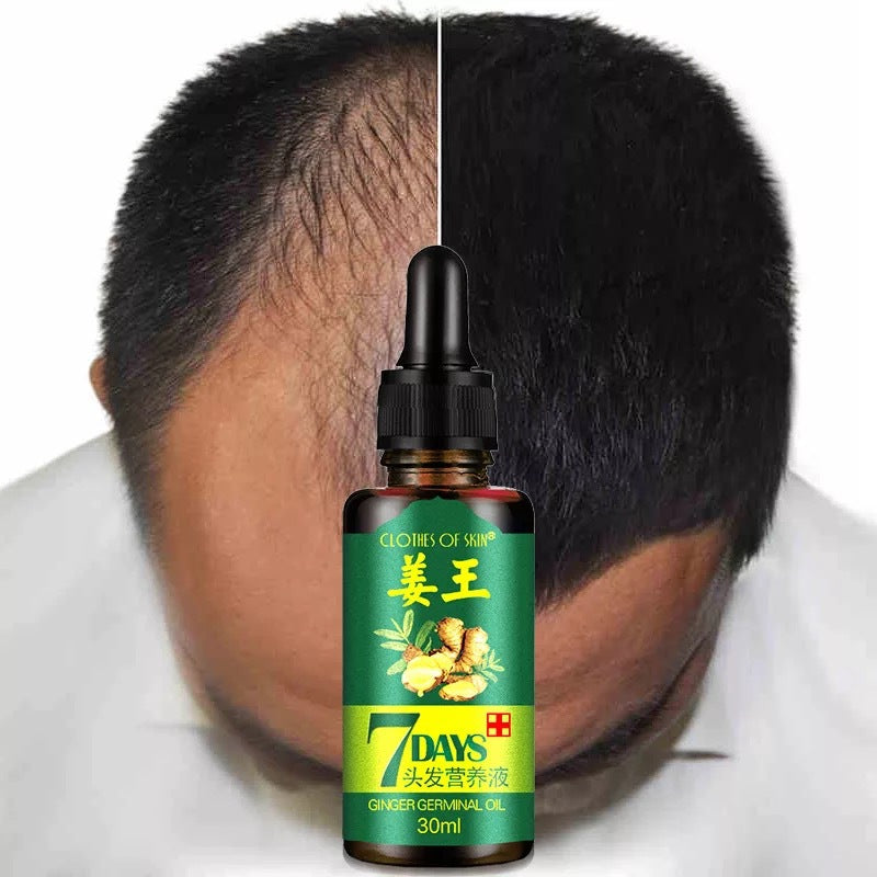 Ginger King Original – Течност за подхранване на скалпа и растеж на косата