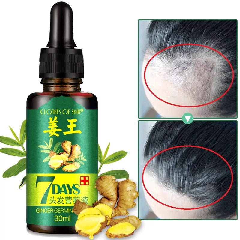 Ginger King Original – Течност за подхранване на скалпа и растеж на косата